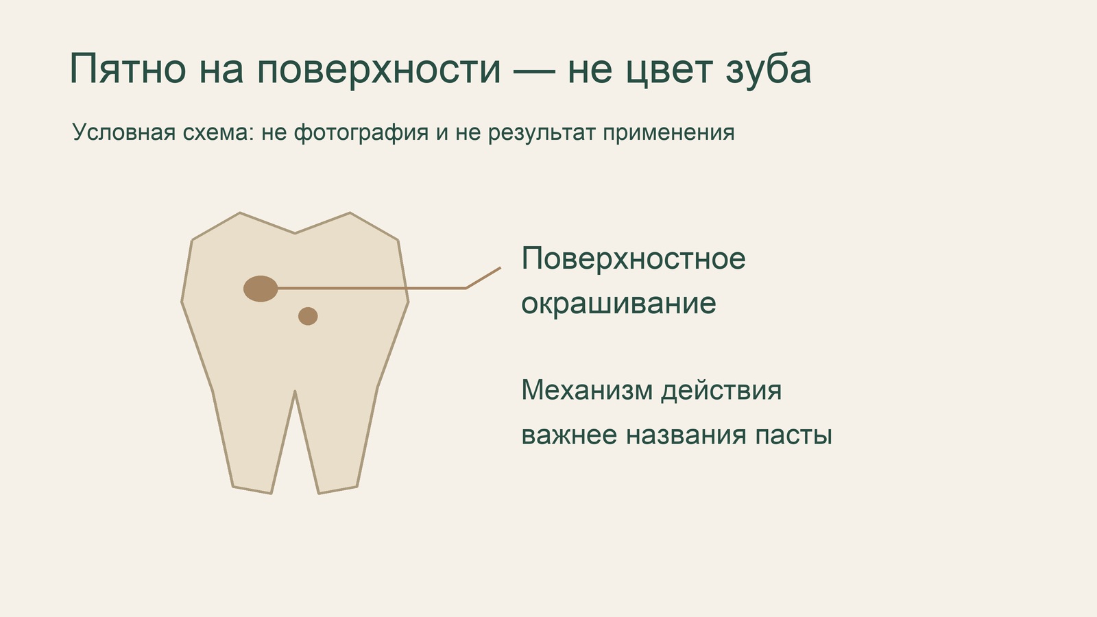 Схема поверхностных пятен на зубе